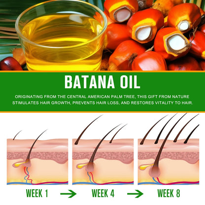 Batana Oil-Natural Conditioner-Moisturizes Hair & Scalp-100% Pure & Natural Organic Essential Oil for Hair,Skin-4.04 Fl.Oz